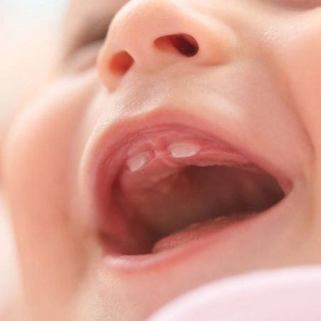 Premiere dent bébé - Laboratoires Gilbert